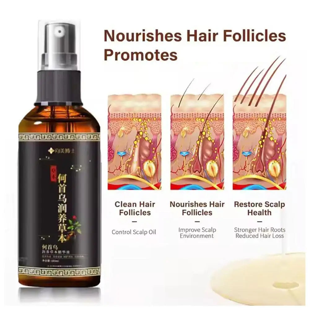 Hair Serum Hair Growth Serum Spray For Men And Women,Hair Loss Solution Polygonum Multiflori Radix, Ginger,Hair Care Essence Oil