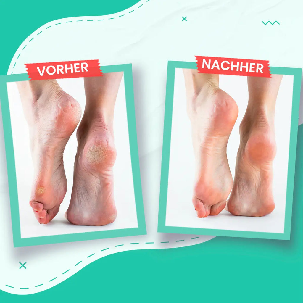 Fußcreme Für Trockene & Rissige Haut